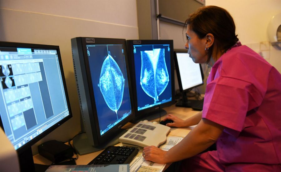 Photo of a doctor looking at mammograms