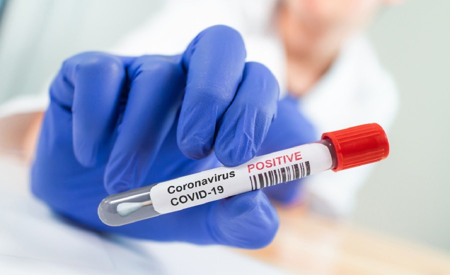 coronavirus COVID-19 testing nasal swabs northwell health new york cases southern florida university tampa health hospital patients clinical trial 3D printing