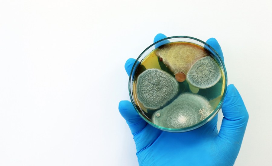 hand in medical gloves holding petri dish with bacteria cultures growing in swirling colonies