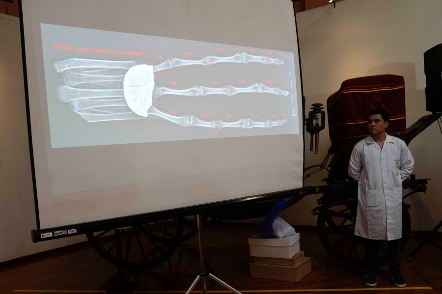 A forensic archaeologist stands next a projection of a three-fingered hand, which was seized by authorities, at the Archeology Museum in Lima, Peru, Friday, Jan. 12, 2024. According to forensic archaeologist Flavio Estrada from Peru's prosecutor's office, two dolls and a three-fingered hand, which were seized before being shipped to Mexico, are constructed of paper, glue, metal, human and animal bones. (AP Photo/Martin Mejia)