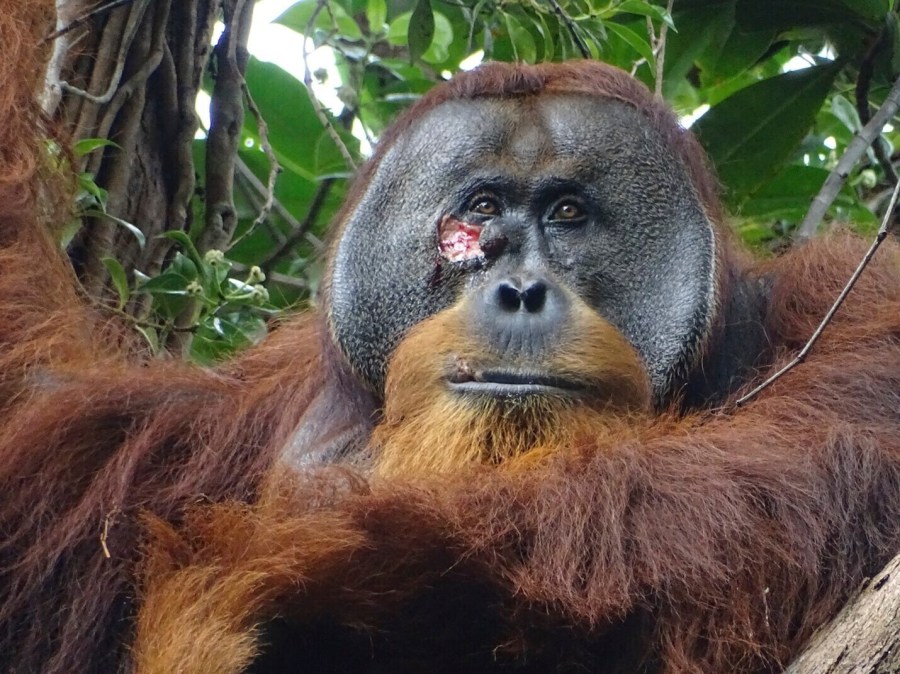 This photo provided by the Suaq foundation shows a facial wound on Rakus, a wild male Sumatran orangutan in Gunung Leuser National Park, Indonesia, on June 23, 2022, two days before he applied chewed leaves from a plant, used throughout Southeast Asia to treat pain and inflammation and to kill bacteria, to the wound. (Armas/Suaq foundation via AP)