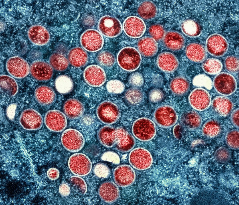 FILE - This image provided by the National Institute of Allergy and Infectious Diseases shows a colorized transmission electron micrograph of monkeypox particles (red) found within an infected cell (blue), cultured in the laboratory that was captured and color-enhanced at the NIAID Integrated Research Facility in Fort Detrick, Md. Kenya and the Central African Republic declared new outbreaks of mpox Wednesday, July 31, 2024, as Africa's health officials are racing to contain the spread of the disease in a region lacking vaccines. (NIAID via AP, File)