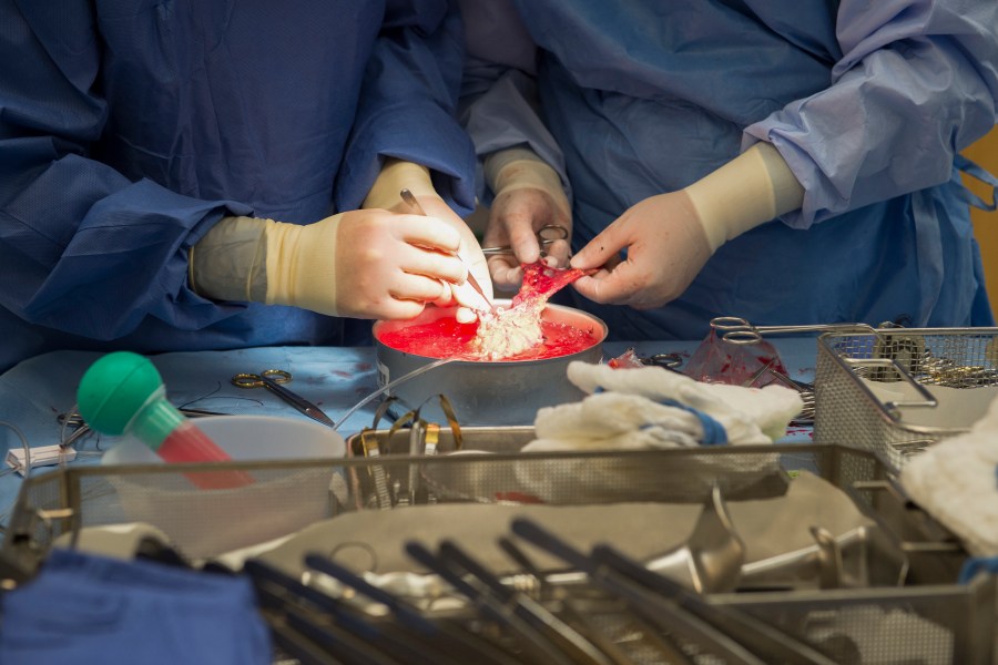 FILE - Surgeons work on a kidney during a transplant surgical procedure in Washington on June 28, 2016. (AP Photo/Molly Riley, File)